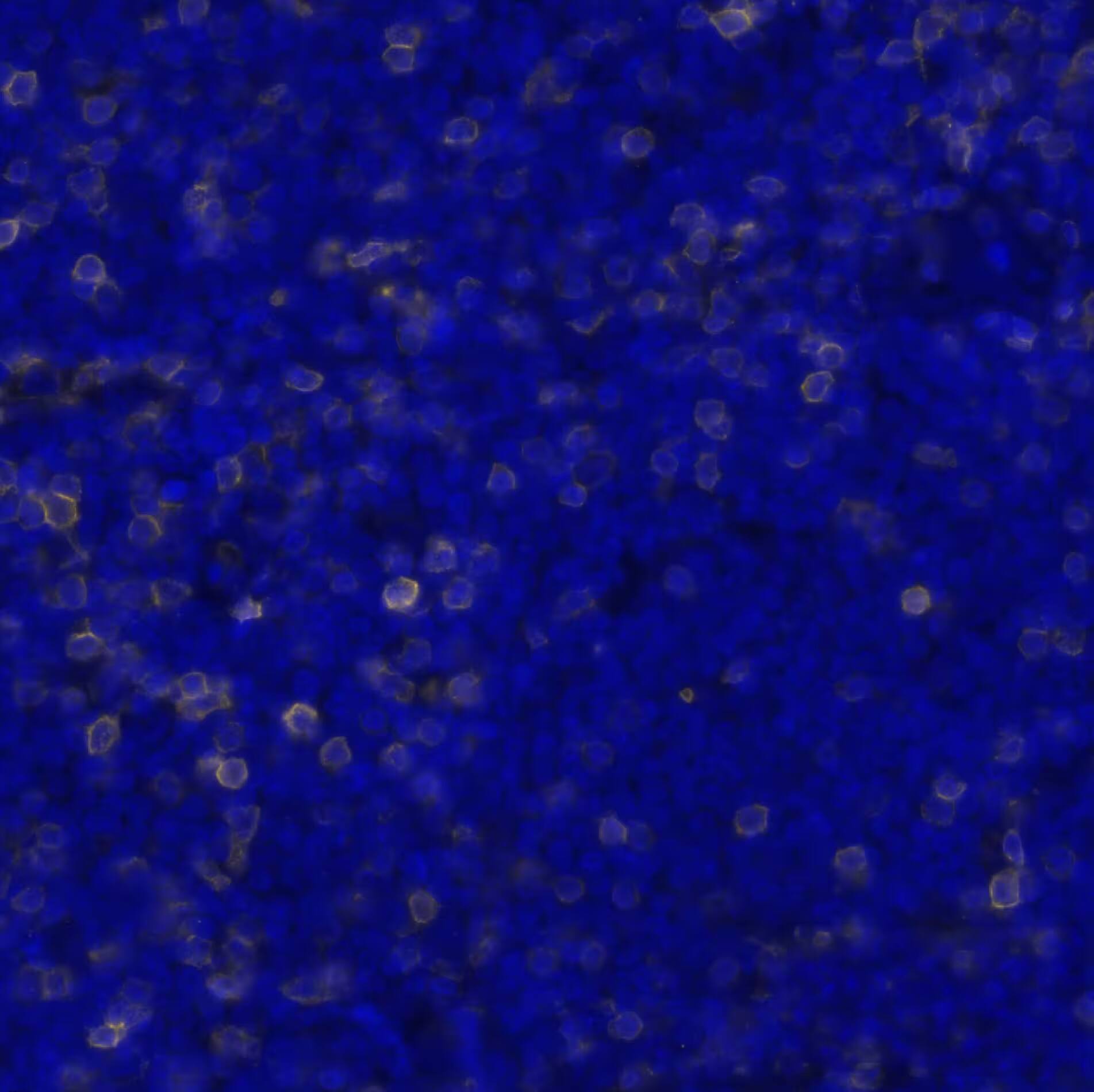CD5 Antibody (CL12334) - BSA Free Detection of CD5 in Human Mantle Cell Lymphoma via seqIF&trade; staining on COMET&trade;